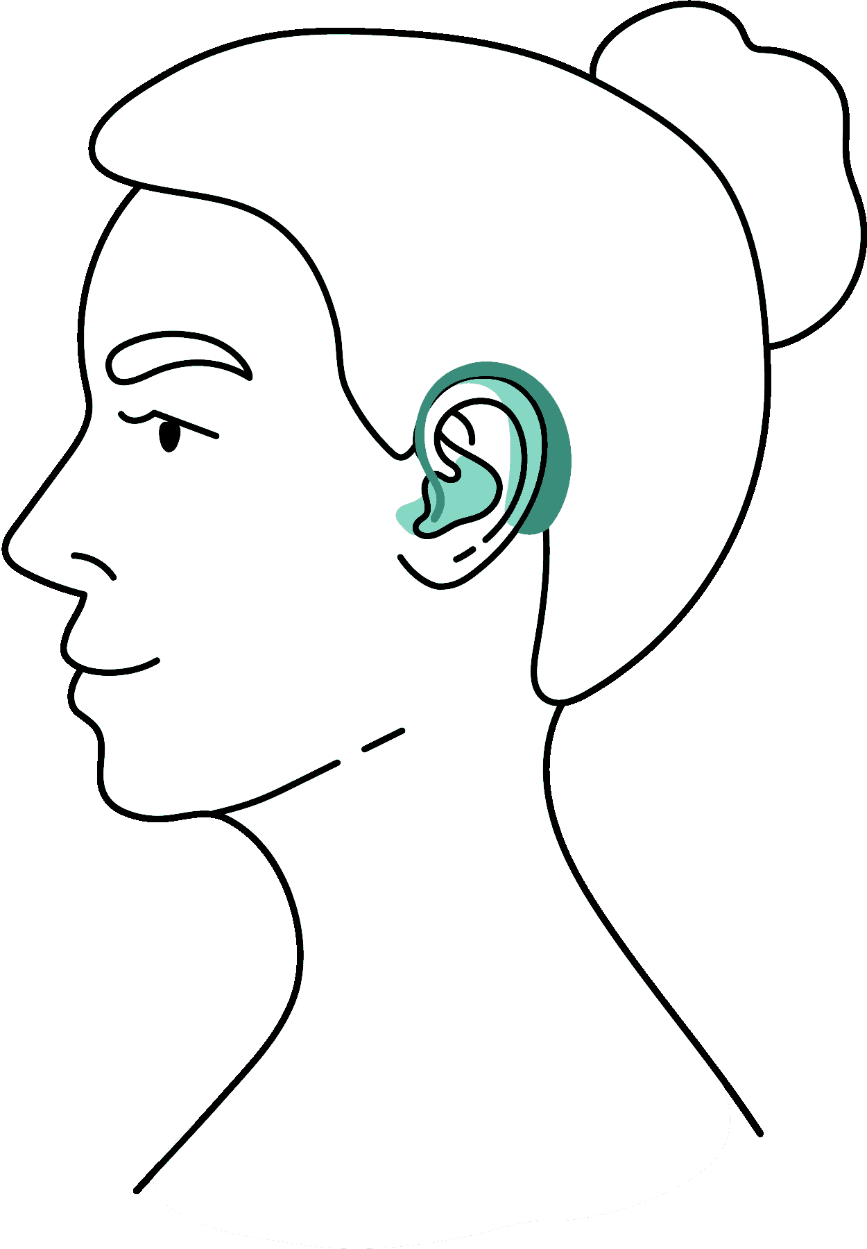 Receiver in Ear (RIC)